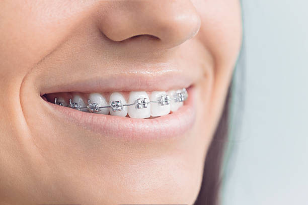  Brown City, MI Dental Services Pros